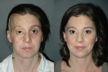 Reconstructive Plastic Surgery